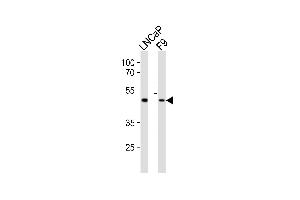 Western blot analysis of lysates from LNCaP, mouse F9 cell line (from left to right), using Sox17 Antibody (C-term) (ABIN6243372 and ABIN6577631). (SOX17 antibody  (C-Term))