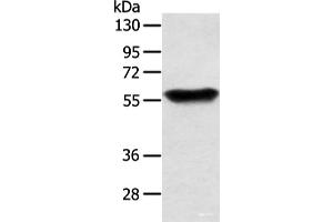 Western blot analysis of Human fetal brain tissue using SLC1A3 Polyclonal Antibody at dilution of 1:350 (SLC1A3 antibody)