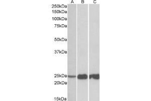AP32708PU-N TNNI2 Antibody (0. (TNNI2 antibody)