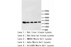 Image no. 1 for anti-Phosphoserine antibody (ABIN1495566) (Phosphoserine antibody)