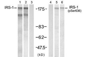 Western blot analysis of extracts from 293 cells treated with insulin(100nM, 30min) or PMA (0. (IRS1 antibody)