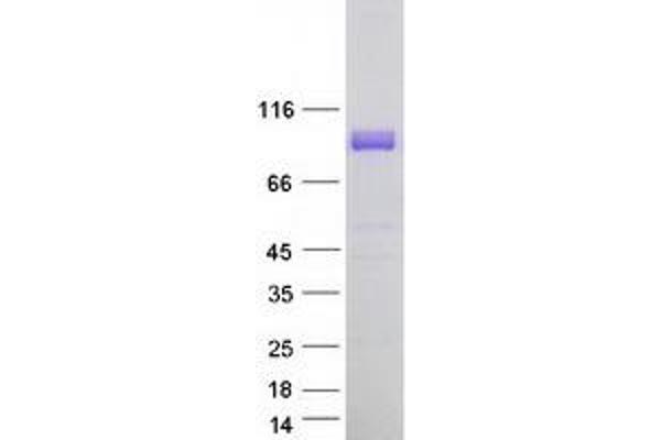 MEG3 Protein (Transcript Variant 1) (Myc-DYKDDDDK Tag)