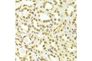 Immunohistochemistry (Paraffin-embedded Sections) (IHC (p)) image for anti-Lamin A/C (LMNA) (AA 403-572) antibody (ABIN3020785)