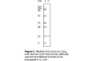 Image no. 2 for anti-CD19 Molecule (CD19) antibody (ABIN207604) (CD19 antibody)