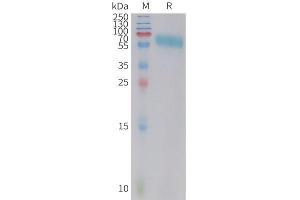 Cynomolgus 4-1BB Protein, hFc Tag on SDS-PAGE under reducing condition. (CD137 Protein (AA 24-186) (Fc Tag))