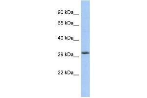 FGF13 antibody used at 1 ug/ml to detect target protein. (FGF13 antibody  (Middle Region))