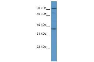 FGFR2 antibody used at 0. (FGFR2 antibody  (Middle Region))