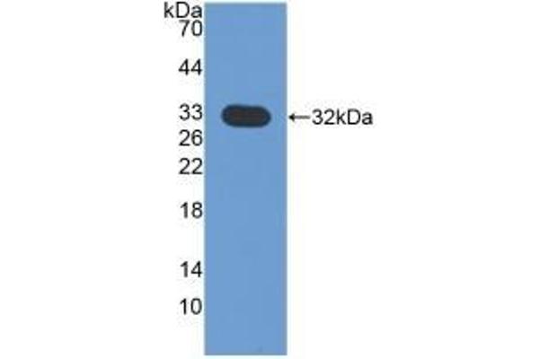 壳三糖苷酶1抗体（AA 210-464）