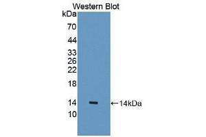 Western blot analysis of the recombinant protein. (IL18R1 antibody  (AA 147-255))