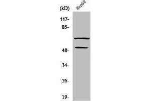 Western Blot analysis of COLO205 cells using SYT Polyclonal Antibody (SS18 antibody  (N-Term))