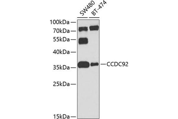 CCDC92 antibody  (AA 1-331)