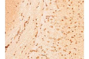 ABIN6267221 at 1/100 staining mouse brain tissue sections by IHC-P. (CHEK1 antibody  (pSer296))