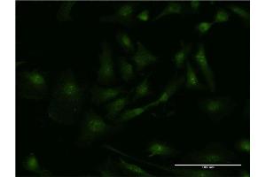 Immunofluorescence of monoclonal antibody to SMAD3 on HeLa cell. (SMAD3 antibody  (AA 1-110))