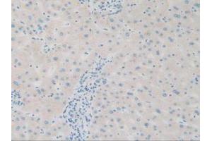 IHC-P analysis of Human Liver Tissue, with DAB staining. (SQSTM1 antibody  (AA 136-400))