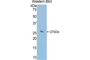 Detection of Recombinant IL2Rb, Mouse using Polyclonal Antibody to Interleukin 2 Receptor Beta (IL2Rb) (IL2 Receptor beta antibody  (AA 27-240))