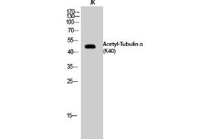 Western Blot analysis of JK cells using Acetyl-Tubulin α (K40) Polyclonal Antibody. (alpha Tubulin antibody  (acLys40))