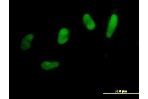 Immunofluorescence of purified MaxPab antibody to SNAI2 on HeLa cell. (SLUG antibody  (AA 1-268))