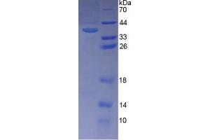 SDS-PAGE analysis of Human PITPNb Protein. (PITPNB Protein)