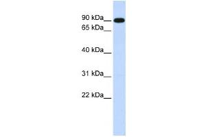 Western Blotting (WB) image for anti-Zinc Finger, X-Linked, Duplicated A (ZXDA) antibody (ABIN2458346) (ZXDA antibody)