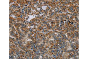 Immunohistochemistry (IHC) image for anti-Hydroxysteroid (17-Beta) Dehydrogenase 14 (HSD17B14) antibody (ABIN2430257) (HSD17B14 antibody)