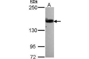 WB Image Sample (30 ug of whole cell lysate) A: A431 , 5% SDS PAGE antibody diluted at 1:1000 (ARHGEF5 antibody  (N-Term))