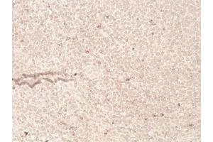 Immunohistochemistry analysis of human tonsil tissue (20x) using LAG-3 (human) recombinant mAb (L4-PL33), at a dilution of 1:50. (LAG3 antibody  (N-Term))