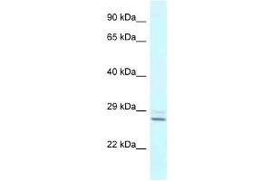 Western Blot showing TPPP antibody used at a concentration of 1 ug/ml against Fetal Liver Lysate (Tppp antibody  (N-Term))