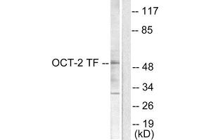Western Blotting (WB) image for anti-POU domain, class 2, transcription factor 2 (POU2F2) (N-Term) antibody (ABIN1848706) (Oct-2 antibody  (N-Term))
