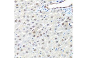 Immunohistochemistry of paraffin-embedded rat liver using PRPF19 antibody at dilution of 1:100 (40x lens). (PRP19 antibody)