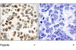 Image no. 1 for anti-Breast Cancer 1 (BRCA1) (Ser1423) antibody (ABIN197481) (BRCA1 antibody  (Ser1423))