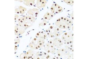 Immunohistochemistry of paraffin-embedded human stomach using RAB3IP antibody. (RAB3IP antibody  (AA 1-150))