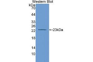 Detection of Recombinant MMP12, Rat using Polyclonal Antibody to Matrix Metalloproteinase 12 (MMP12) (MMP12 antibody  (AA 100-286))