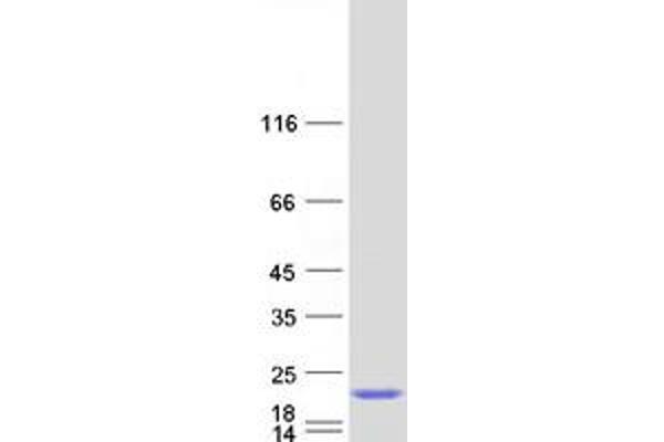 GEMIN6 Protein (Myc-DYKDDDDK Tag)