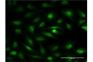 Immunofluorescence of monoclonal antibody to ZBTB7A on HeLa cell. (ZBTB7A antibody  (AA 1-108))