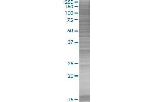 LYPLA1 transfected lysate. (LYPLA1 293T Cell Transient Overexpression Lysate(Denatured))