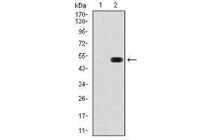 Image no. 2 for anti-Fibronectin 1 (FN1) antibody (ABIN1498273) (Fibronectin 1 antibody)