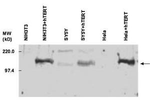 Western Blotting (WB) image for anti-Telomerase Reverse Transcriptase (TERT) (C-Term) antibody (ABIN6655122)