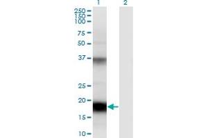 Western Blot analysis of UBD expression in transfected 293T cell line by UBD monoclonal antibody (M01), clone 7D8. (UBD antibody  (AA 1-165))