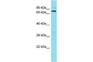 Western Blotting (WB) image for anti-Sosondowah Ankyrin Repeat Domain Family Member B (SOWAHB) (C-Term) antibody (ABIN2791404) (SOWAHB antibody  (C-Term))
