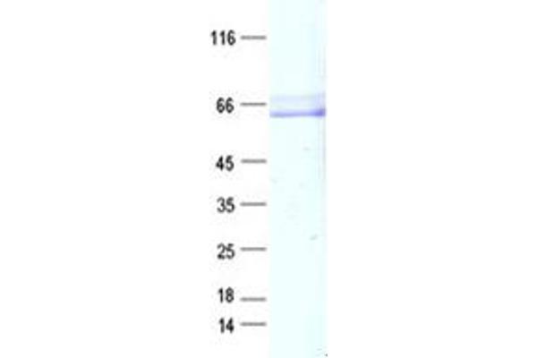 SH3BP5 Protein (DYKDDDDK Tag)