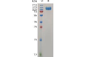 Human IF Protein, mFc Tag on SDS-PAGE under reducing condition. (IFNAR1 Protein (AA 28-436) (mFc Tag))