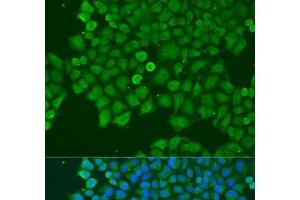 Immunofluorescence analysis of U2OS cells using CAST Polyclonal Antibody at dilution of 1:100. (Calpastatin antibody)