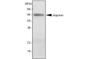 The extract of mouse liver was resolved by SDS-PAGE, transferred to PVDF membrane and probed with anti-human adiponectin antibody (1:2000). (ADIPOQ antibody  (AA 15-244))