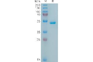Human APRIL Protein, hFc Tag on SDS-PAGE under reducing condition. (TNFSF13 Protein (Fc Tag))