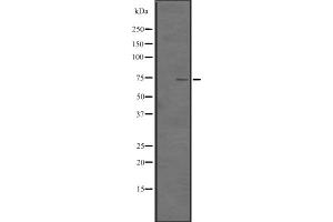 Western blot analysis of TNF18 expression in HEK293 cells ,The lane on the left is treated with the antigen-specific peptide. (TNFSF18 antibody)