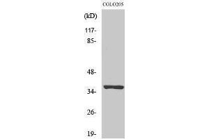 OR52E5 antibody  (Internal Region)