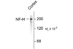 Western blots of rat cortex lysate showing specific immunolableing of the ~200k NF-H protein. (NEFH antibody)