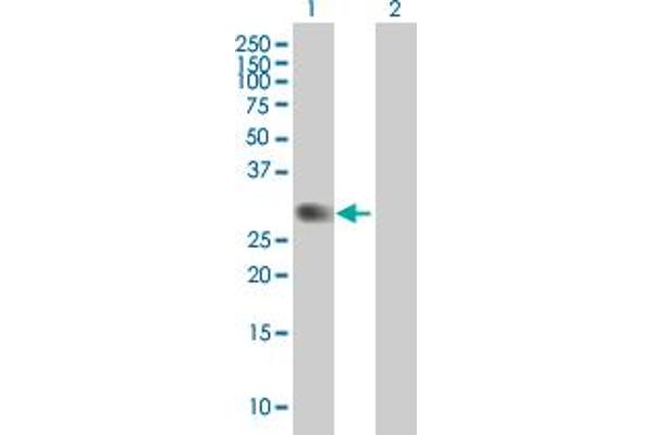 PVRIG antibody  (AA 38-326)