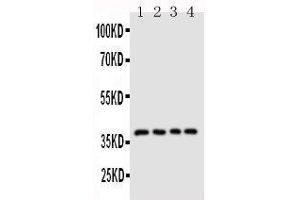 Anti-CD1d antibody, Western blotting Lane 1: COLO320 Cell Lysate Lane 2: HELA Cell Lysate Lane 3:  Cell Lysate Lane 4: JURKAT Cell Lysate (CD1d antibody  (N-Term))