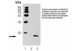 Image no. 1 for anti-Histone 3 (H3) (pSer10) antibody (ABIN363923) (Histone 3 antibody  (pSer10))